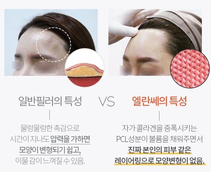엘란쎄-효과