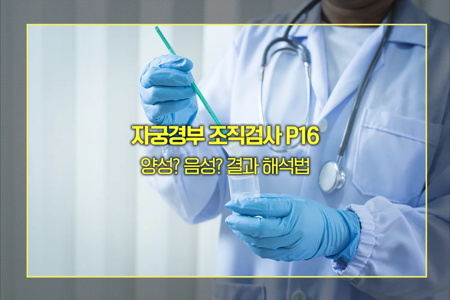 자궁경부조직검사-p16양성-음성-해석