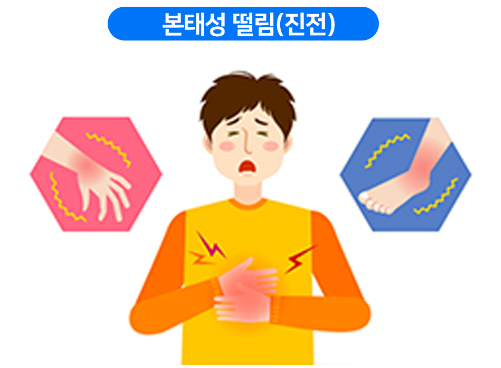 본태성 진전(수전)의 발병 연령