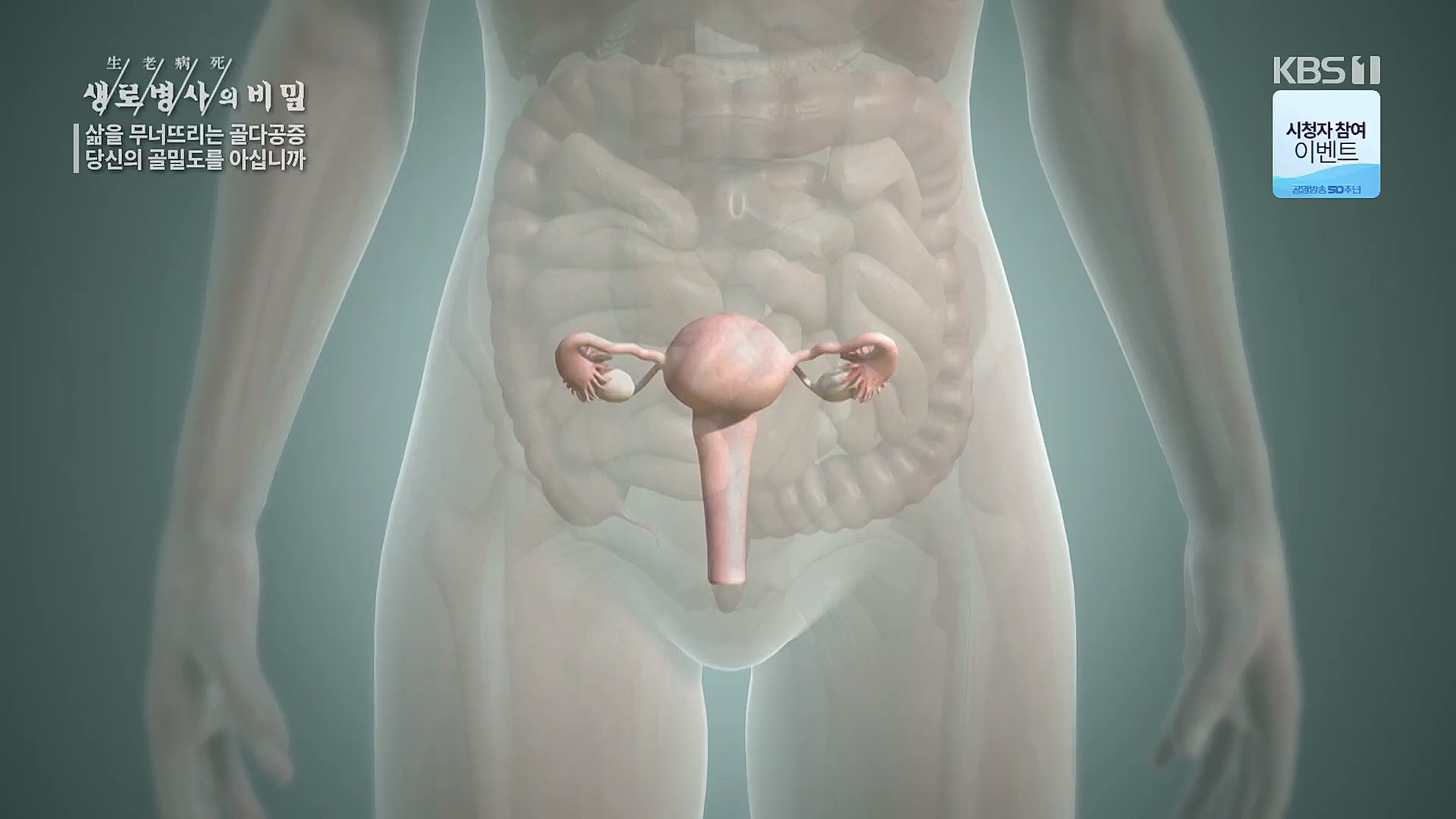 생로병사의 비밀.E852.230118p.H264-F1RST.mp4_20230120_200308.517.jpg