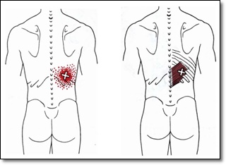 하후거근의 통증유발점과 연관통을 나타낸 그림