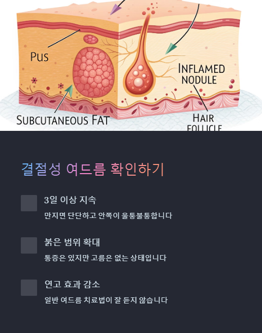 결절성 여드름 확인하기