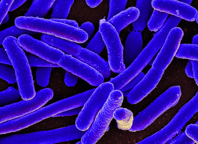  나쁜 세균 감염이 지속되는 이유 STUDY PROVIDES CLUES ON WHY SOME BAD INFECTIONS PERSIST