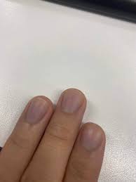 손톱으로 보는 건강상태