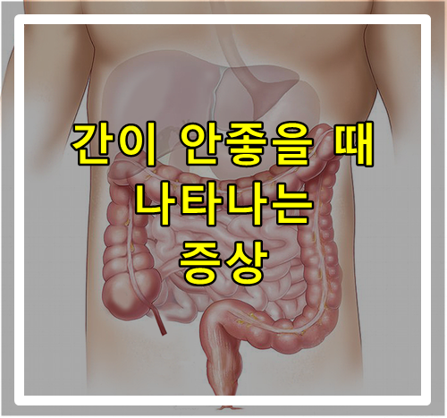  간 기능이 떨어졌을 때 나타나는 증상 7가지
