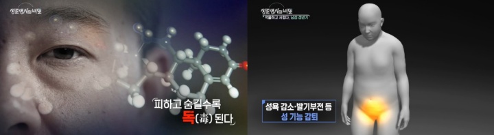 생로병사의비밀-남성-갱년기
