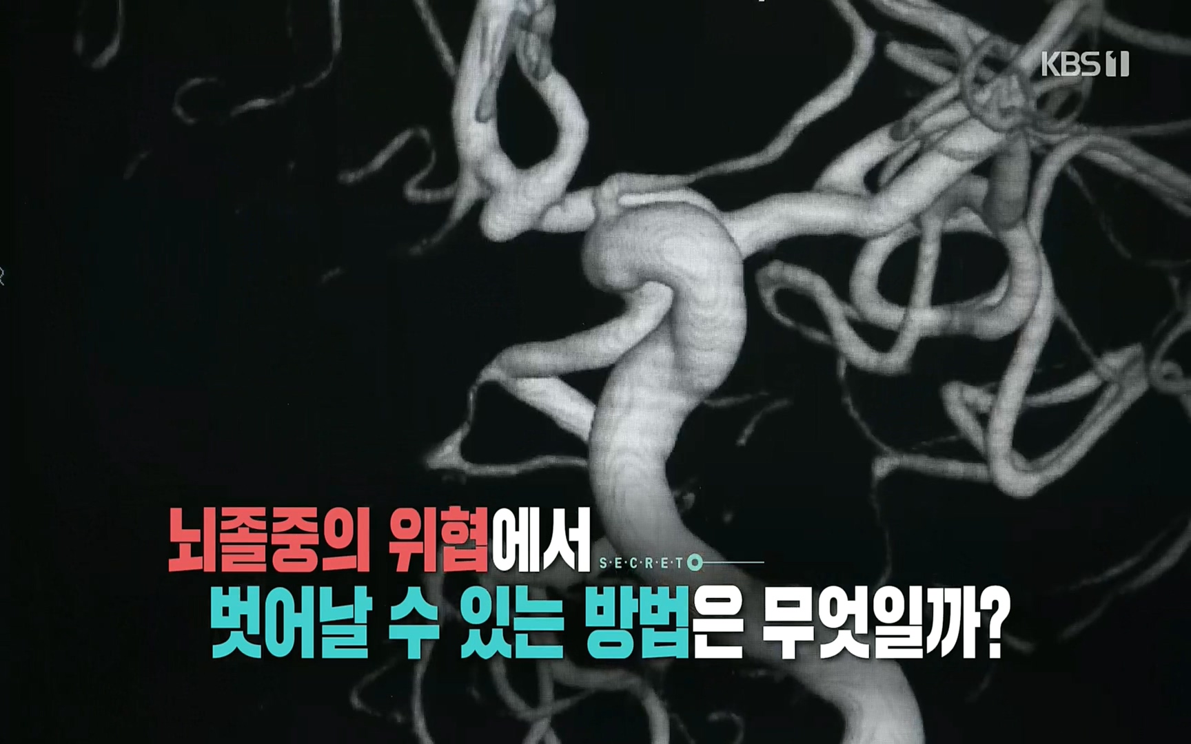 생로병사의 비밀.E835p.H264-F1RST.mp4_20220917_175424.851.jpg