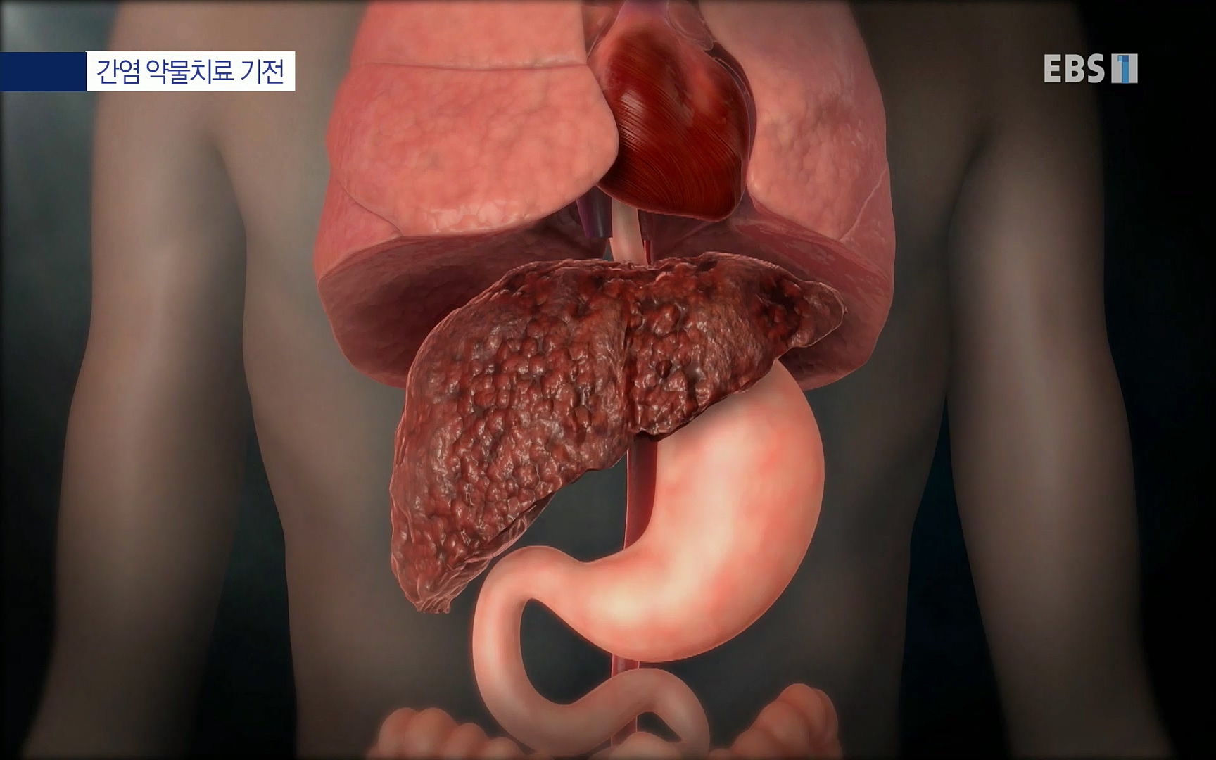 EBS 명의 헬스케어 - TV - 교육의 중심 EBS명의 15년 - 간, 완치에 도전하다.mp4_20220802_202428.494.jpg