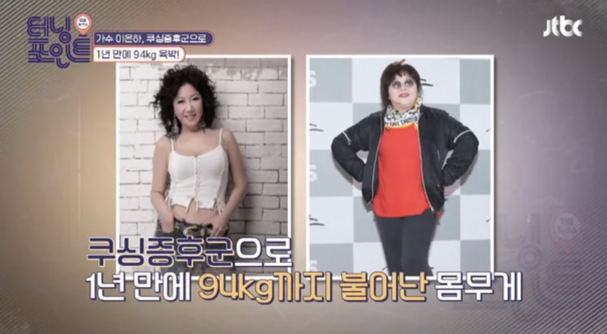 가수-이은하
