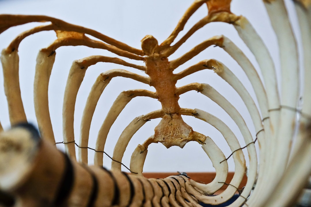 Spinal stenosis