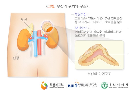  "TV는 사랑을 싣고" 가수 이은하 쿠싱증후군이 뭐길래??