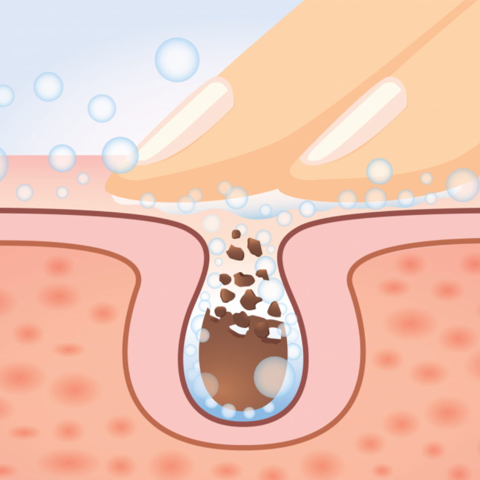 초음파 마사지 효능 초음파마사지 13