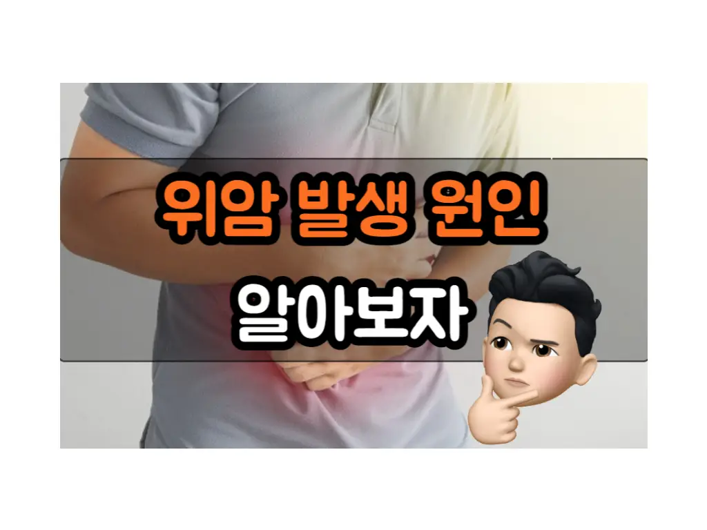 위암 발생 원인&#44; 증상 및 건강한 식습관 유지 방법