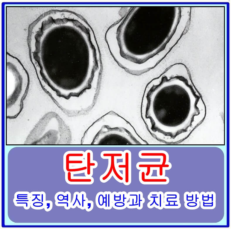  탄저균의 특징, 역사, 예방과 치료 방법 총정리