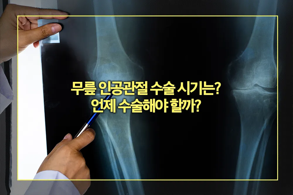 무릎 인공관절 수술 시기 언제 수술