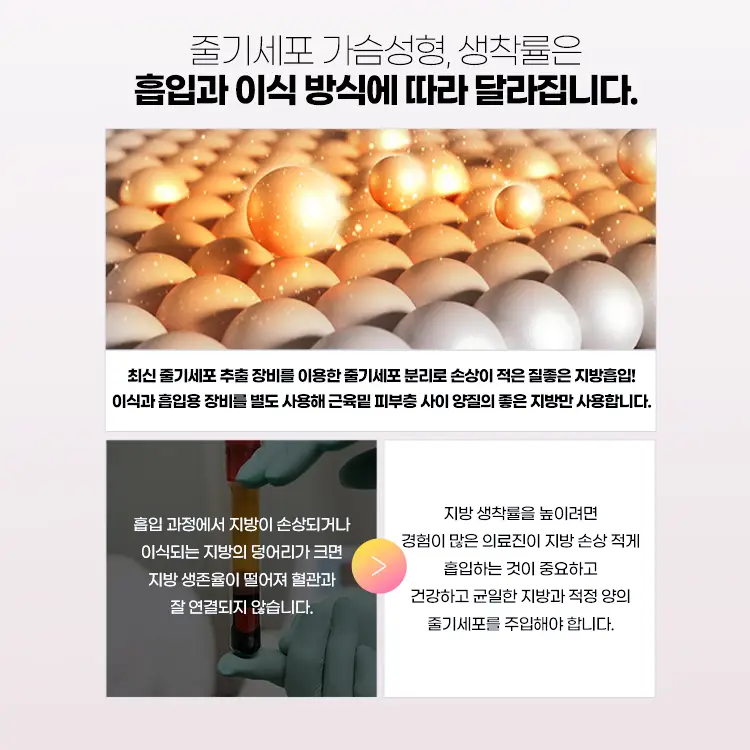 최신줄기세포 추출 장비를 이용한 줄기세포 분리로 손상이 적은 질좋은 지방흡입