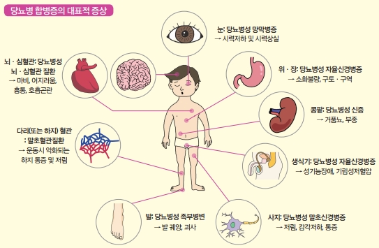 당뇨병-초기증상