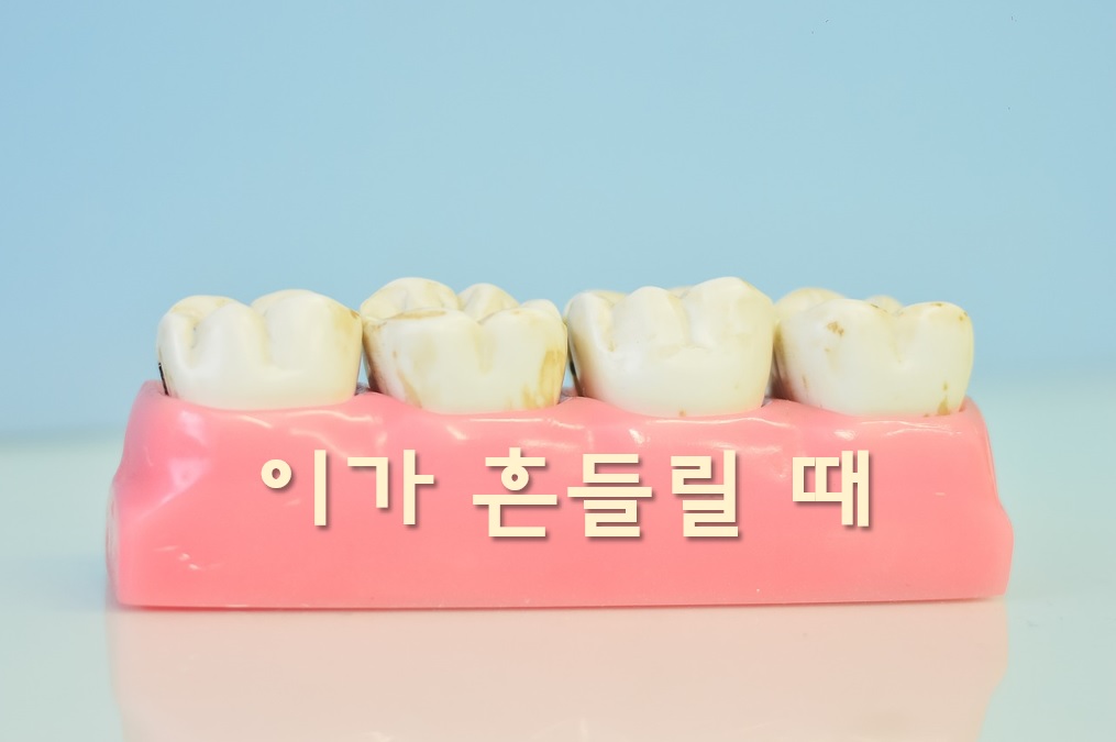  이가 흔들릴 때와 이가 아플 때 처치방법