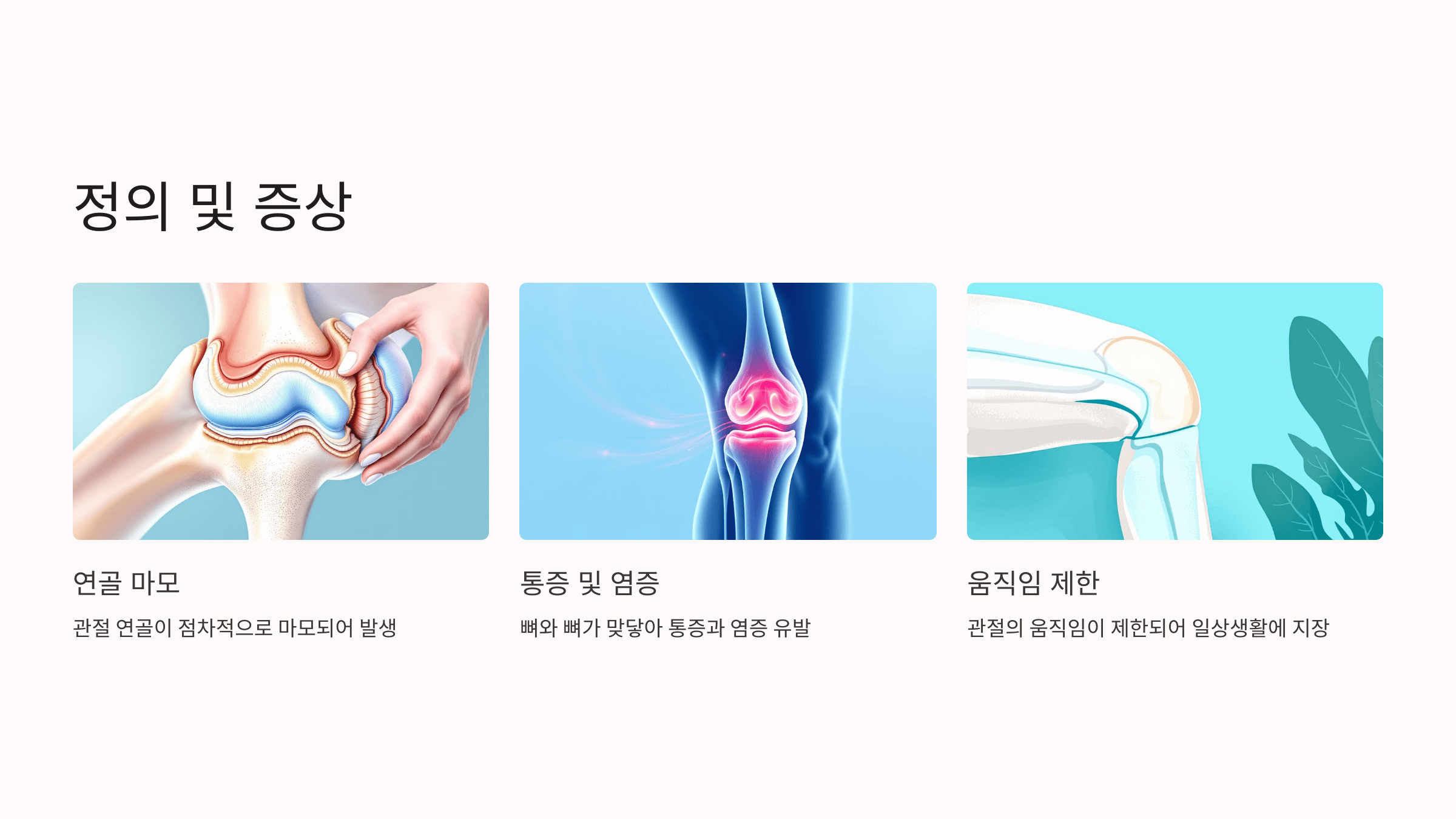 퇴행성 관절염과 관련된 사진입니다.