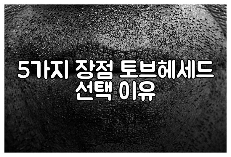 5가지 장점 토브헤세드 선택 이유