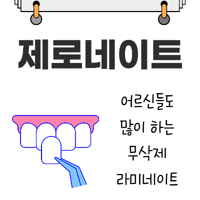 제로네이트 치료: 어르신들도 많이 하는 무삭제 라미네이트