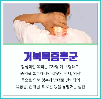 거북목 증상 치료법 스트레칭_23