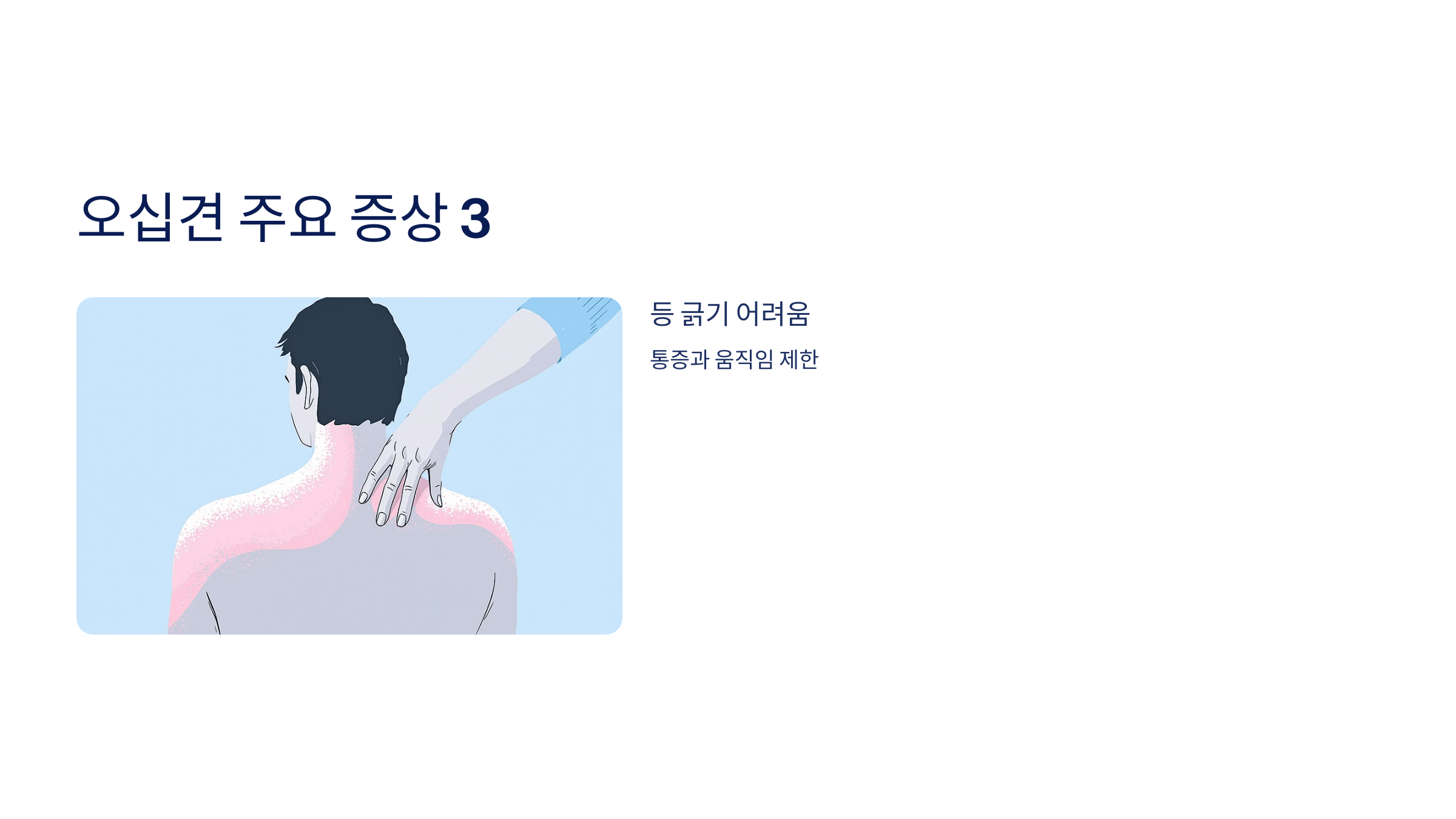 오십견 사진입니다.