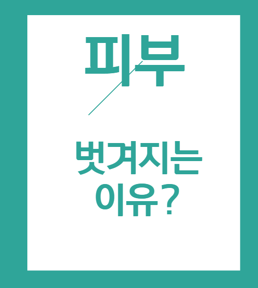 피부 벗겨짐 현상