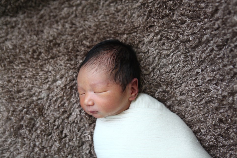 치료 너무 걱정하지 마세요 신생아 황달 원인과 수치, 16