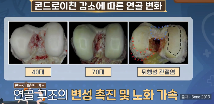 콘드로이친 효능 