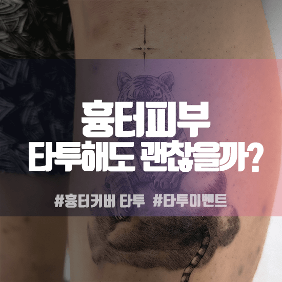 흉터 커버를 위한 작은 호랑이 타투