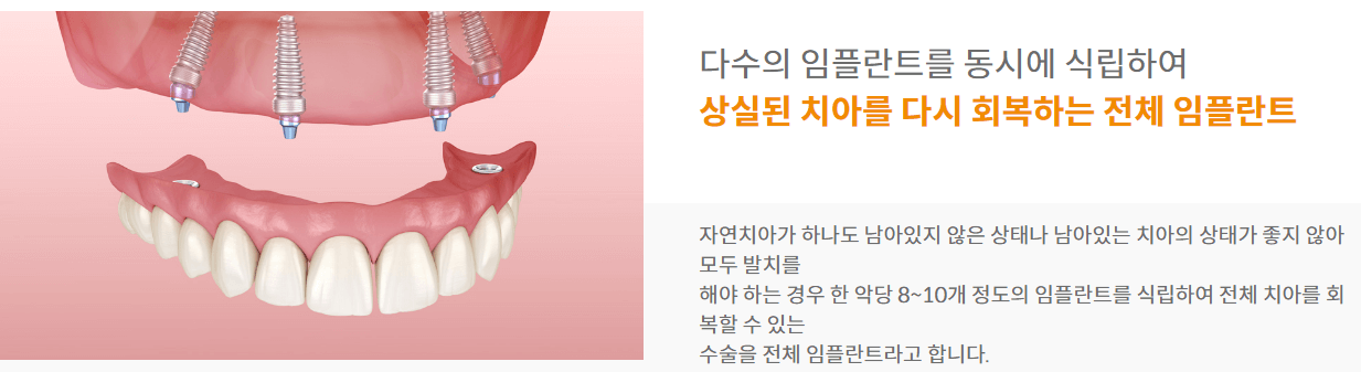 임플란트 비용 무상지원 대상 신청방법