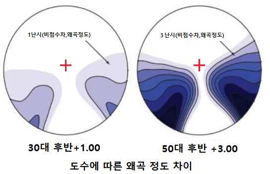 도수에 따른 왜곡 정도 차이를 설명한 그림
