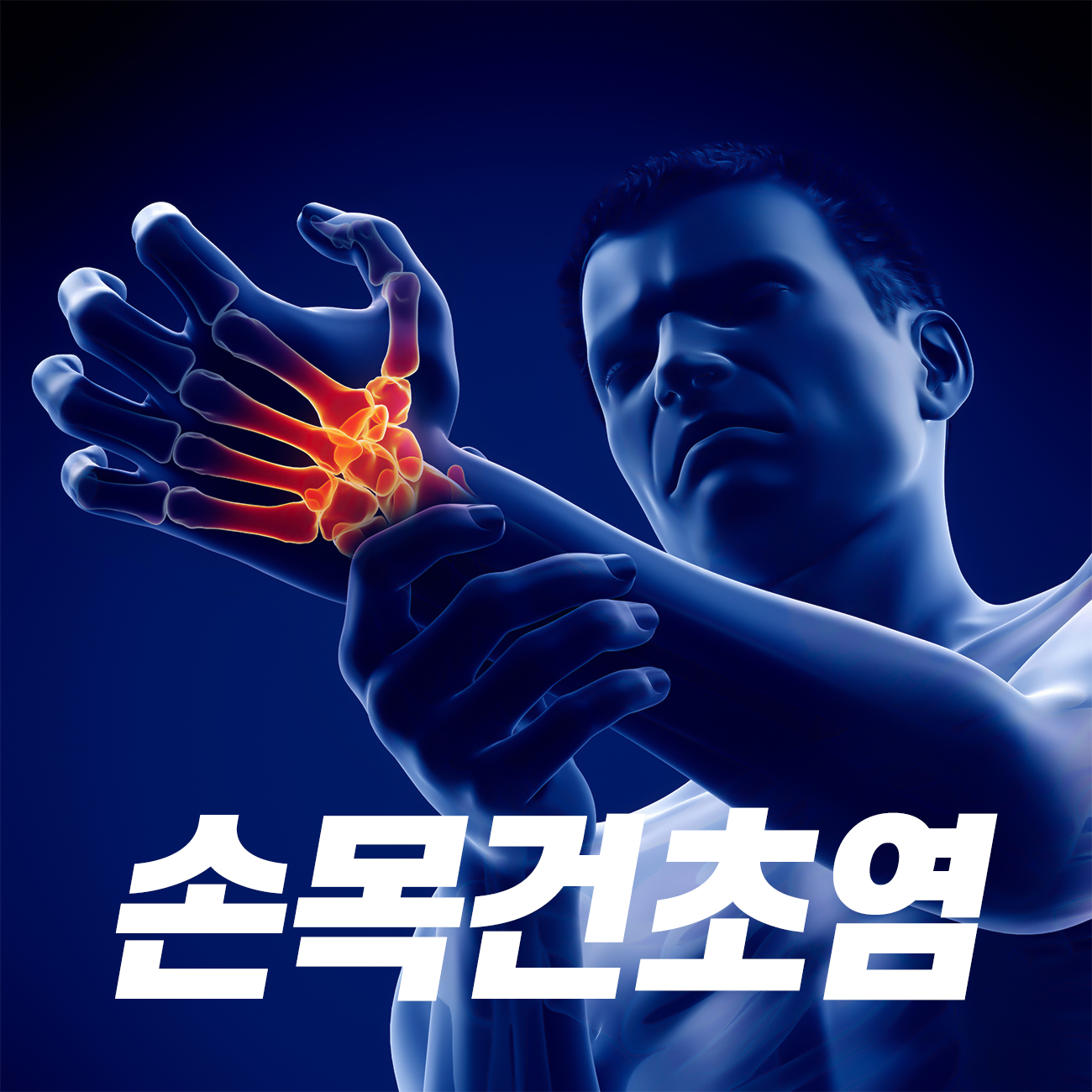  불광역통증의학과 우리를 괴롭히는 손목 건초염 원인