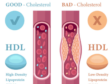 hdl 콜레스테롤 이란? 정상수치 및 높이는 방법