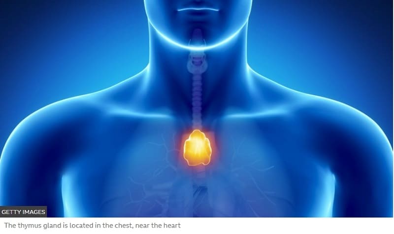 '세계 최초' 심장-흉선 이식 성공 'World-first' heart-thymus transplant success for Easton