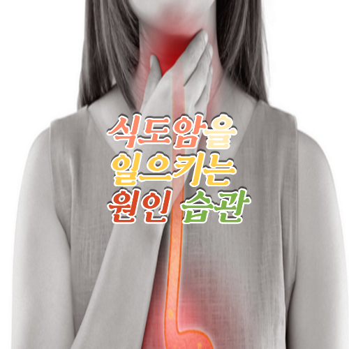  식도암을 일으키는 원인 습관