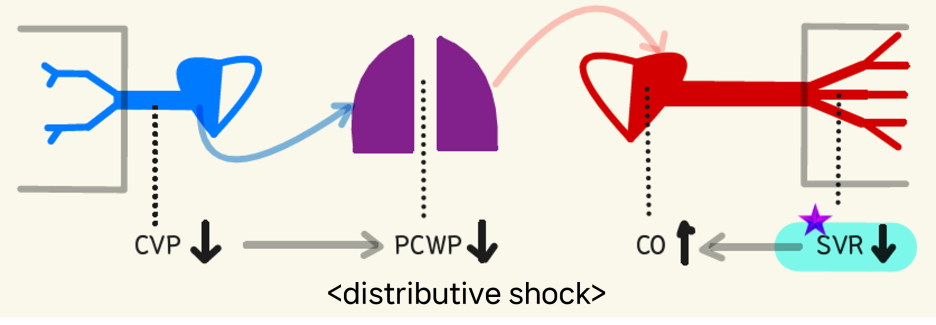 distributive shock