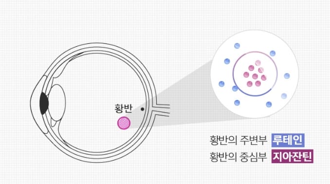 황반