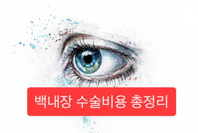  백내장 수술비용 총정리