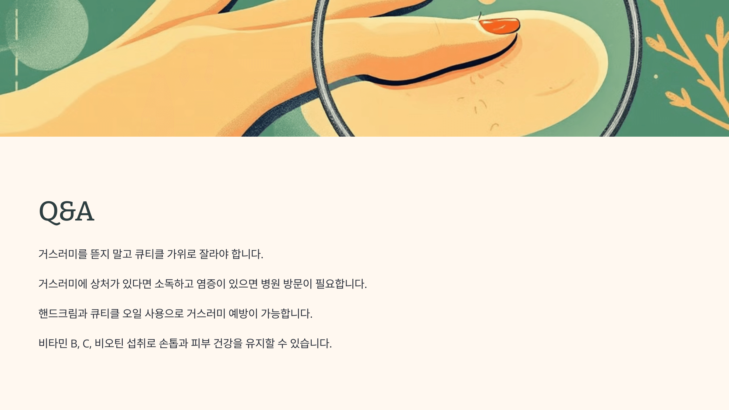 손톱 거스러미와 관련된 사진입니다.