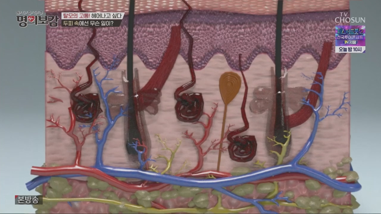 메디컬다큐 명의보감.E03.230527p.H264-F1RST.mp4_20230529_173118.316.jpg