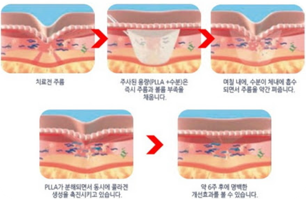 콜라겐모든것711