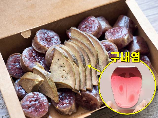 혓바늘 치료 빨리 낫는 법,구내염에 좋은 음식 순대간