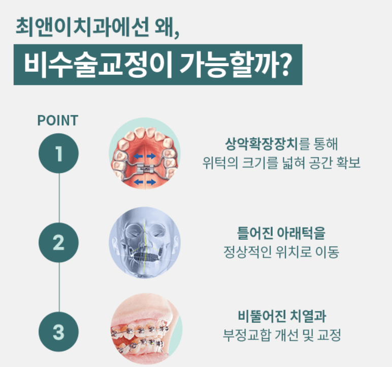 얼굴 안면 비대칭 원인 자가교정 병원후기