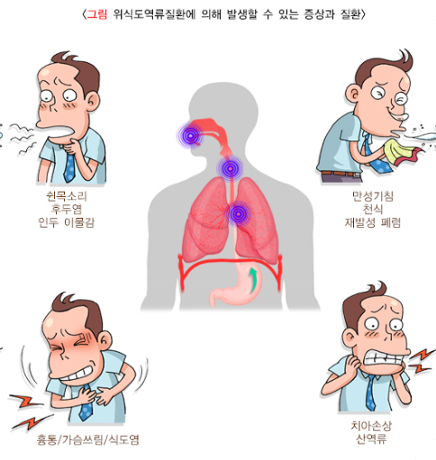 가슴답답할때2