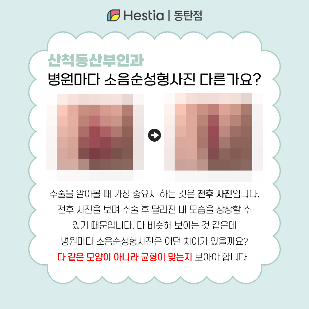 산척동산부인과 소음순성형사진 동탄 여의사 산부인과 산척동산부인과 병원마다 소음순성형사진 다를까..?