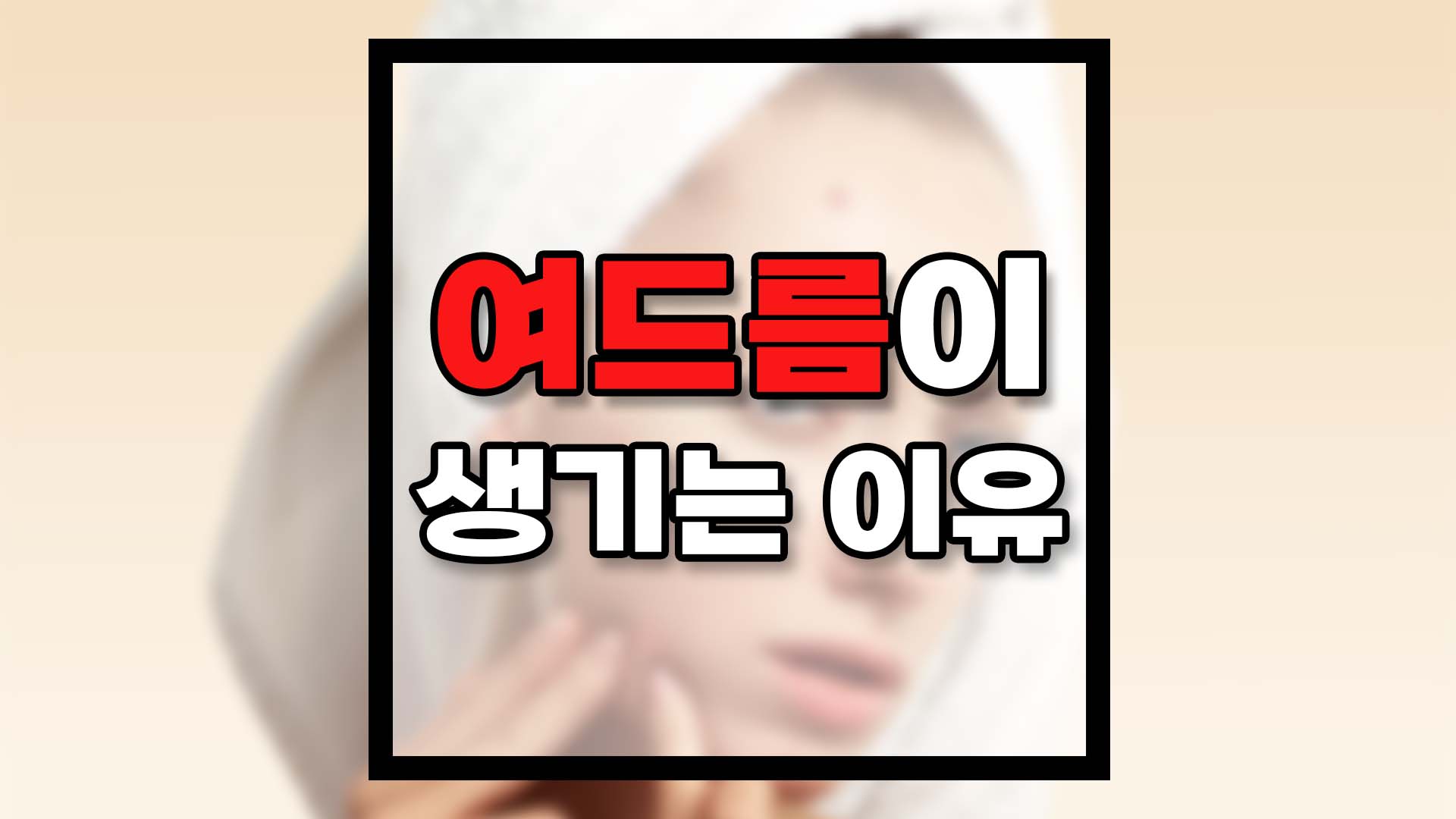  여드름이 생기는 이유