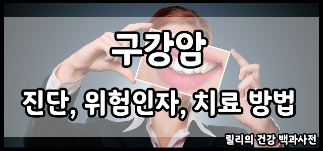  구강암 : 구강암 진단, 구강암 위험 인자, 구강암 치료 방법
