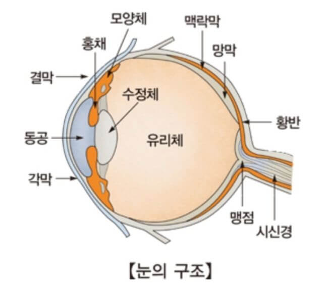 녹내장 증상